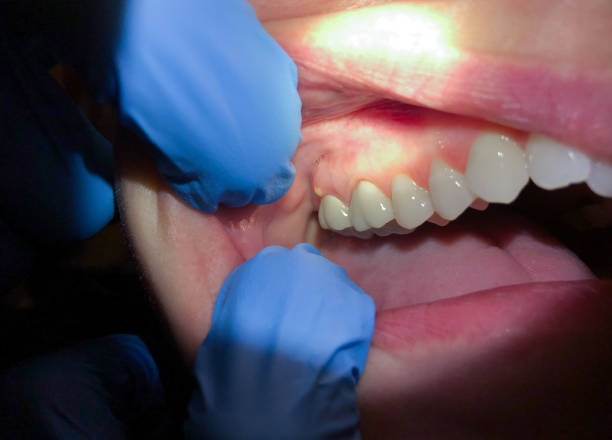Best Cosmetic Emergency Dentistry in Bothell West, WA