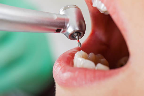 Best Emergency TMJ Treatment in Bothell West, WA